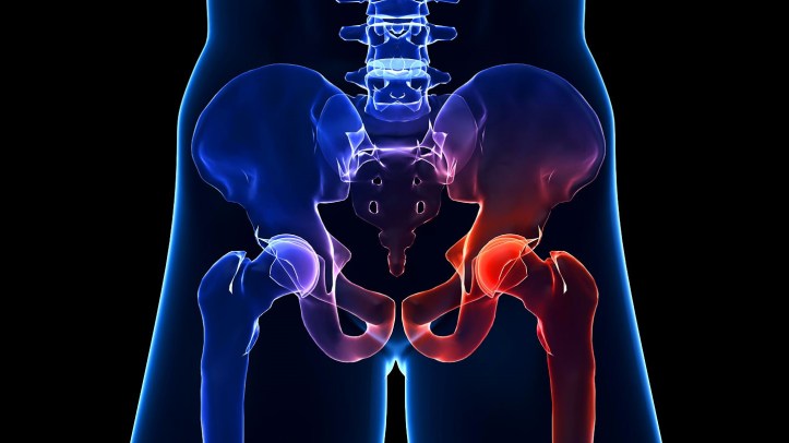 minimally-invasive-hip-surgery-not-always-right-choice-1440x810